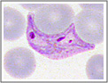 Striscio sottile. Plasmodium vivax: emazia parassitata da due trofozoiti