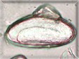 Enterobius vermicularis egg (pinworm)