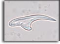 Echinococcus sp, uncino. Per saperne di più: Division of Parasitic Diseases (DPDx)-CDC.