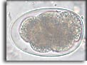 Uovo di anchilostoma. Per saperne di più: Division of Parasitic Diseases (DPDx)-CDC.