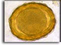 Uovo di Ascaris lumbricoides. Per saperne di più: Division of Parasitic Diseases (DPDx)-CDC.