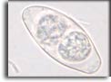 Oocisti matura di Cystoisospora belli. Per saperne di più: Division of Parasitic Diseases (DPDx)-CDC.