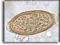 Uovo di Trichuris trichiura. Per saperne di più: Division of Parasitic Diseases (DPDx)-CDC.