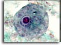 Trofozoite di Iodamoeba butschlii. Per saperne di più: Division of Parasitic Diseases (DPDx)-CDC.