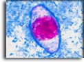 Oocisti immatura di Cystoisospora belli. Per saperne di più: Division of Parasitic Diseases (DPDx)-CDC.