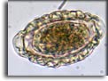 Uovo di Dioctophyme renale. Per saperne di più: Division of Parasitic Diseases (DPDx)-CDC.