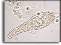 Miracidio di Schistosoma haematobium. Per saperne di più: Division of Parasitic Diseases (DPDx)-CDC.