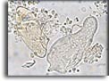 Schiusa di un uovo di Schistosoma haematobium. Per saperne di più: Division of Parasitic Diseases (DPDx)-CDC.