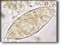 Uovo di Schistosoma haematobium