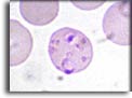 Trofozoite di Plasmodium falciparum. Per saperne di più: Division of Parasitic Diseases (DPDx)-CDC.