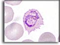 Trofozoite di Plasmodium ovale. Per saperne di più: Division of Parasitic Diseases (DPDx)-CDC.