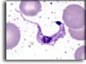 Trypomastigote di Trypanosoma cruzi. Per saperne di più: Division of Parasitic Diseases (DPDx)-CDC.