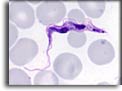 Trypomastigote di Trypanosoma brucei. Per saperne di più: Division of Parasitic Diseases (DPDx)-CDC.