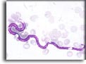 Microfilaria di Mansonella perstans. Per saperne di più: Division of Parasitic Diseases (DPDx)-CDC.