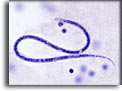 Microfilaria di Mansonella ozzardi. Per saperne di più: Division of Parasitic Diseases (DPDx)-CDC.