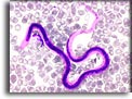 Microfilaria di Wuchereria bancrofti. Per saperne di più: Division of Parasitic Diseases (DPDx)-CDC.