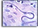 Microfilaria di Onchocerca volvulus. Per saperne di più: Division of Parasitic Diseases (DPDx)-CDC.