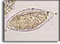 Uovo di Schistosoma haematobium. Per saperne di più: Division of Parasitic Diseases (DPDx)-CDC.