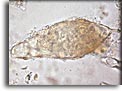 Uovo di Schistosoma intercalatum. Per saperne di più: Division of Parasitic Diseases (DPDx)-CDC.