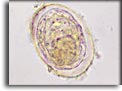 Uovo di Schistosoma japonicum. Per saperne di più: Division of Parasitic Diseases (DPDx)-CDC.