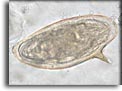 Uovo di Schistosoma mansoni. Per saperne di più: Division of Parasitic Diseases (DPDx)-CDC.