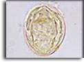 Uovo di Schistosoma mekongi. Per saperne di più: Division of Parasitic Diseases (DPDx)-CDC.