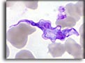 Forma trypomastigonte di Trypanosoma brucei. Per saperne di più: Division of Parasitic Diseases (DPDx)-CDC.