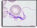 Forma trypomastigote di Trypanosoma brucei. Per saperne di più: Division of Parasitic Diseases (DPDx)-CDC.