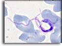 Forma trypomastigonte di Trypanosoma brucei. Per saperne di più: Division of Parasitic Diseases (DPDx)-CDC.