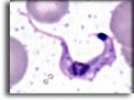 Forme trypomastigoti di Trypanosoma cruzi. Per saperne di più: Division of Parasitic Diseases (DPDx)-CDC.