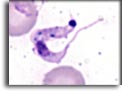 Forma trypomastigonte di Trypanosoma cruzi. Per saperne di più: Division of Parasitic Diseases (DPDx)-CDC.