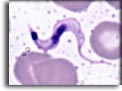 Forma trypomastigonte di Trypanosoma cruzi. Per saperne di più: Division of Parasitic Diseases (DPDx)-CDC.