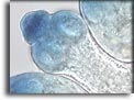 Protoscolice di Echinococcus granulosus. Per saperne di più: Division of Parasitic Diseases (DPDx)-CDC.