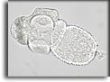 Protoscolice di cisti di Echinococcus granulosus. Per saperne di più: Division of Parasitic Diseases (DPDx)-CDC.