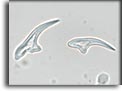 Uncini di Echinococcus granulosus. Per saperne di più: Division of Parasitic Diseases (DPDx)-CDC.