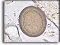 Uovo di Taenia solium. Per saperne di più: Division of Parasitic Diseases (DPDx)-CDC.