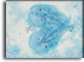 Trofozoiti di Giardia duodenalis. Per saperne di più: Division of Parasitic Diseases (DPDx)-CDC.