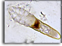 Acari. Demodex folliculorum. Per saperne di più: Division of Parasitic Diseases (DPDx)-CDC.