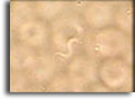 Osservazione microscopica a fresco di un Trypanosoma.
