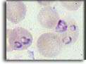 Babesia sp. Per saperne di più: Division of Parasitic Diseases (DPDx)-CDC.