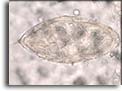 Uovo di Schistosoma haematobium