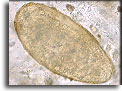 Uovo di Fasciola hepatica (63-90 x 130-150 µm). Per saperne di più: Division of Parasitic Diseases (DPDx)-CDC.