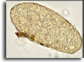 Uovo di Fasciola gigantica (70-95 x 160-190 µm). Per saperne di più: Division of Parasitic Diseases (DPDx)-CDC.